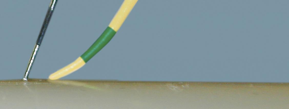 Symbolfoto einer Zahnarzthelferin bei der parodontalen Sondierung am Patienten.