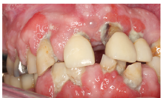 Der diabetische Patient Abb. 4